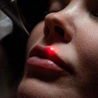 Лазерное лечение губ в Краснодаре